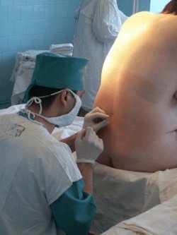 роды без боли и страха