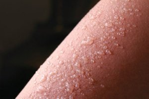 первая помощь при солнечных ожогах