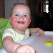 проявление диатеза у детей