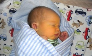 желтушка новорожденных