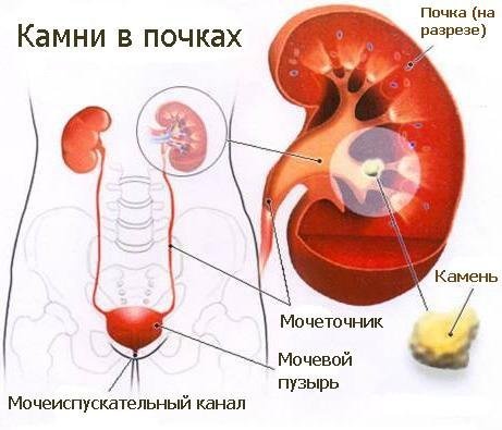 116483612_pesok_v_pochkah.jpg