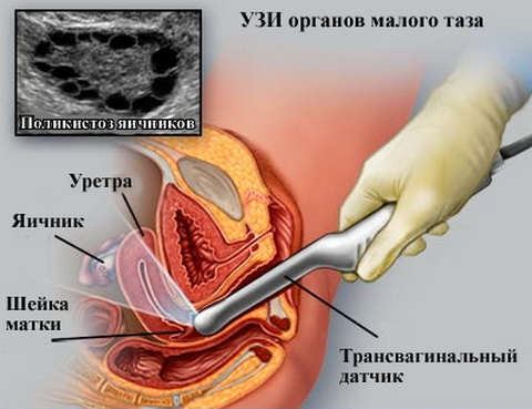 узи женщин