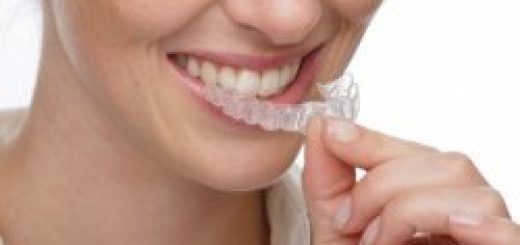 отбелить зубы в домашних условиях1