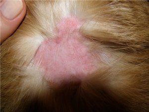 чем лечить лишай