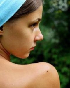 родинки на теле