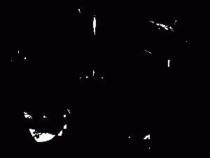 схема для точечного массажа от заикания