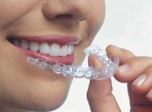 пластинки для зубов