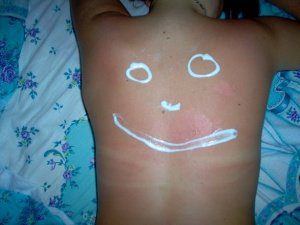 мази от спины