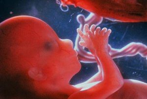 околоплодные воды