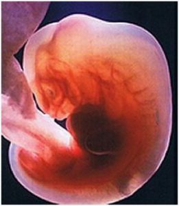 первый месяц беременности