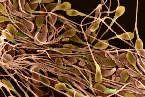 стресс и сперма