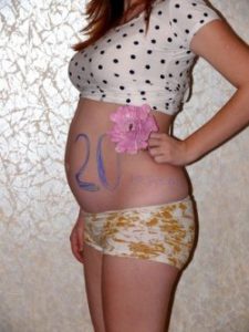 20 неделя беременности