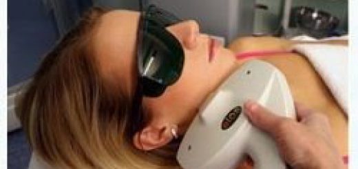 лазерное удаление веснушек