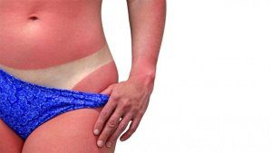 солнце и меланома