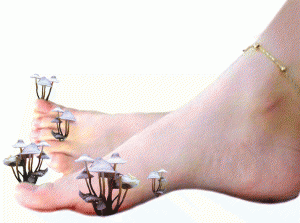 потливость ног