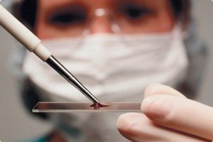 лейкоциты в крови при беременности