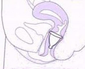 как приблизить месячные