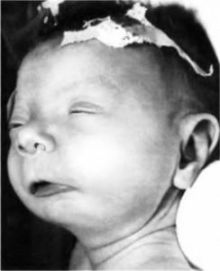 спиртное на ранних сроках беременности