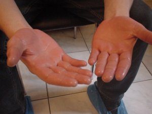 потливость