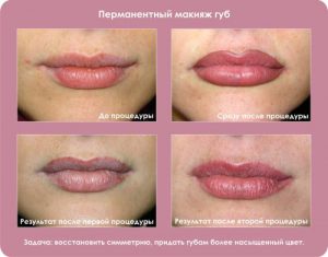 татуаж губ до и после