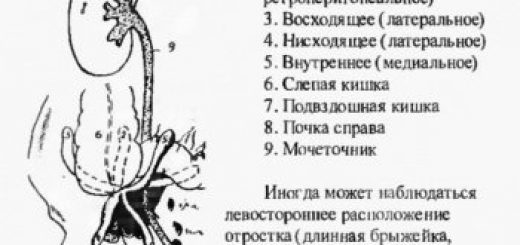 расположение аппендикса