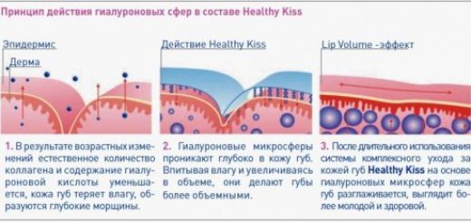 Гиалуроновая кислота схема. Механизм действия гиалуроновой кислоты. Гиалуроновая кислота в организме. Гиалуроновая кислота в коже. Гиалуроновая кислота в теле человека.