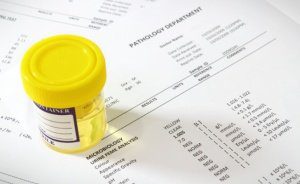 уровень сахара в моче