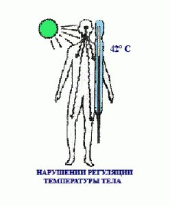 тепловой удар