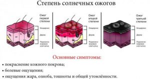 степень солнечных ожогов