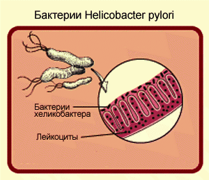 лечение хелибактериоза