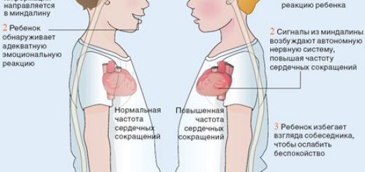 аутизм