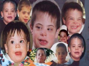 дифференциальная диагностика аутизма