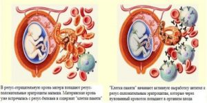 развитие гемолитической желтухи