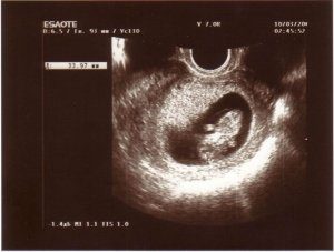 узи 6 недель 4 дня