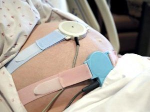 Актовегин во время беременности