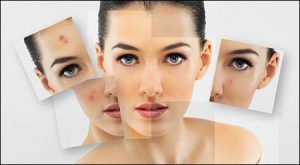 здоровая кожа лица