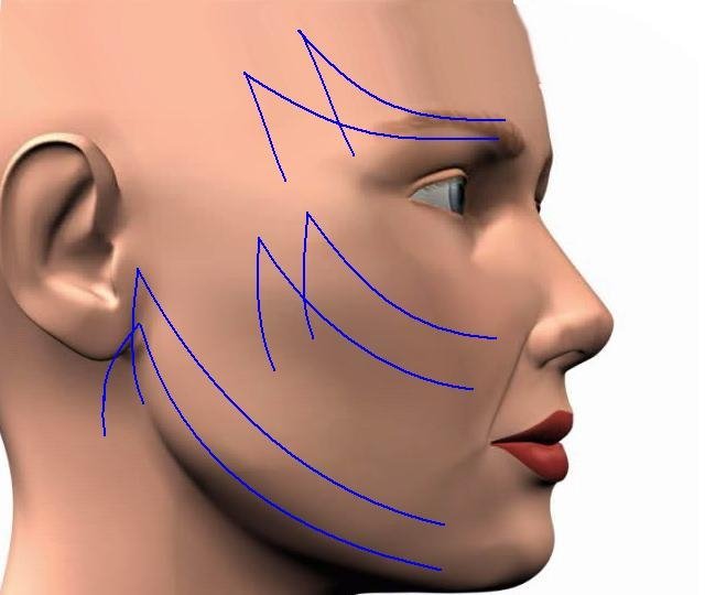 Трети лица. Нити Аптос для подтяжки лица схема. Линия подбородка. Средняя треть лица. Верхняя треть лица.