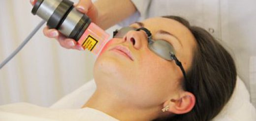 лазерная биоревитализация лица