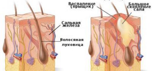 прыщи на затылке