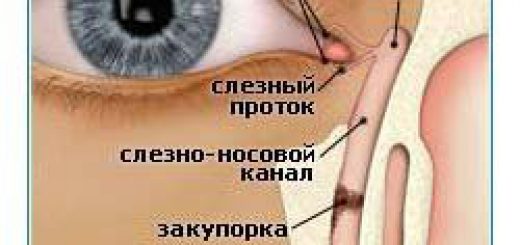 pochemu_u_rebenka_gnoyatsya_glaza_1.jpg