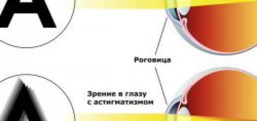зрение при астигматизме фото