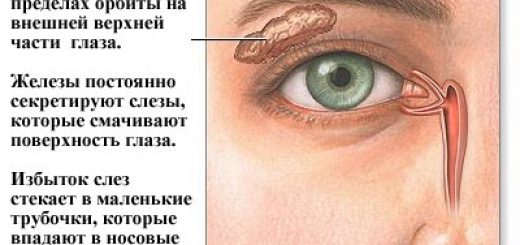 dry_eye.jpg