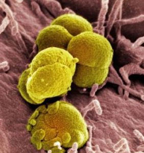 4e1aa9b520740gonorrhea_bacteria-1-.jpg