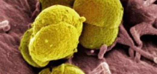 4e1aa9b520740gonorrhea_bacteria-1-.jpg