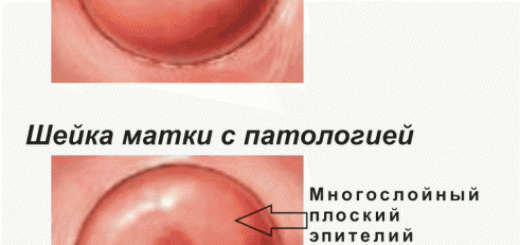 шейка матки