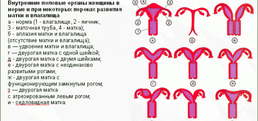 аномалии матки