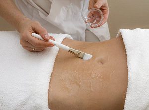 Химический пилинг растяжек