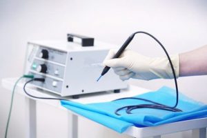 Диатермокоагуляция