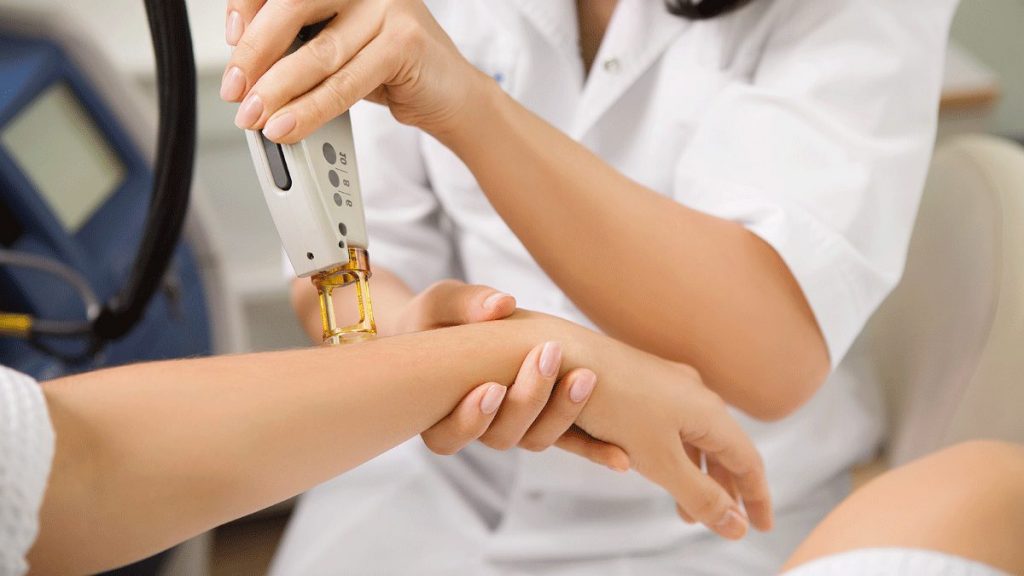 Лазерная эпиляция александритовым лазером